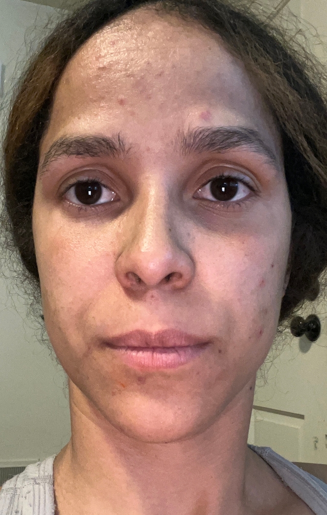 Julissa D., 33 Before