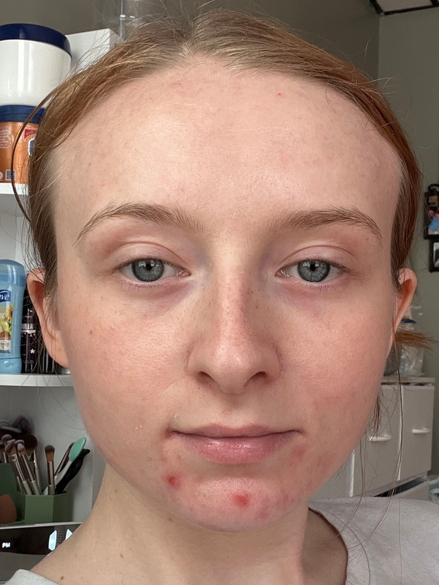 Victoria H., 25 Before